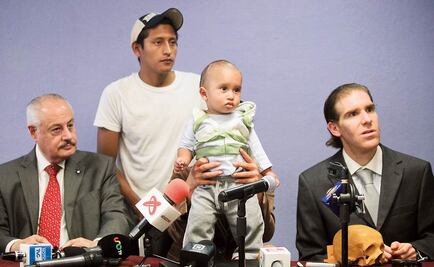 Reconstruyen cráneo de un bebé, con éxito