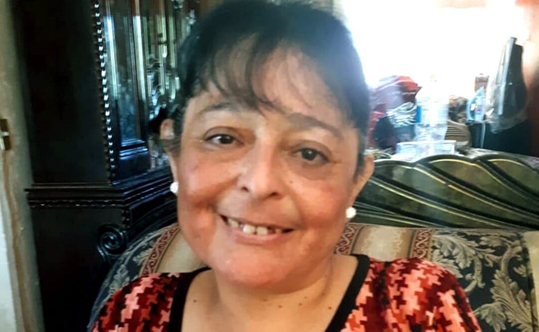 La operación de doña Rosa se llevó con éxito y le regresaron la autoestima. Foto: Especial 