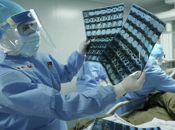 COVID-19 vs the human immune system, a microscopic war with major health consequences