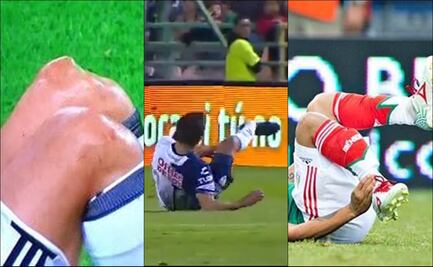 Las terribles lesiones en el futbol mexicano
