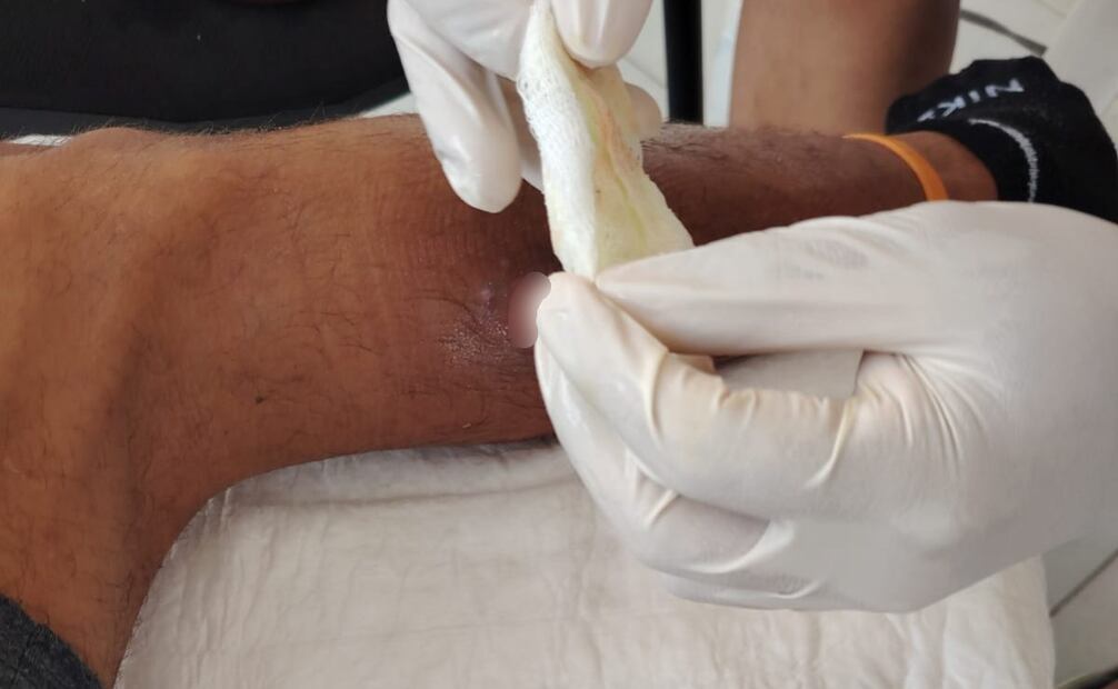 Adrián Rodríguez se infectó de miasis
Foto: Especial.