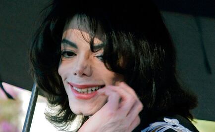 Michael Jackson murió calvo y con cicatrices en el cuerpo