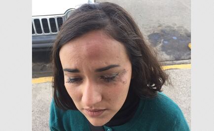 Piden que PGR indague agresión de gendarmes a periodistas