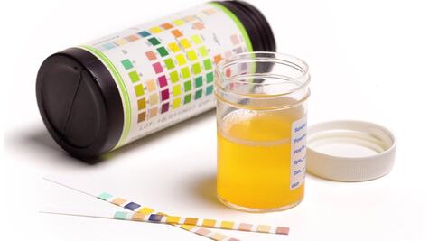 Cistitis, la dolorosa enfermedad que sufre cerca del 50% de las mujeres y es mal diagnosticada