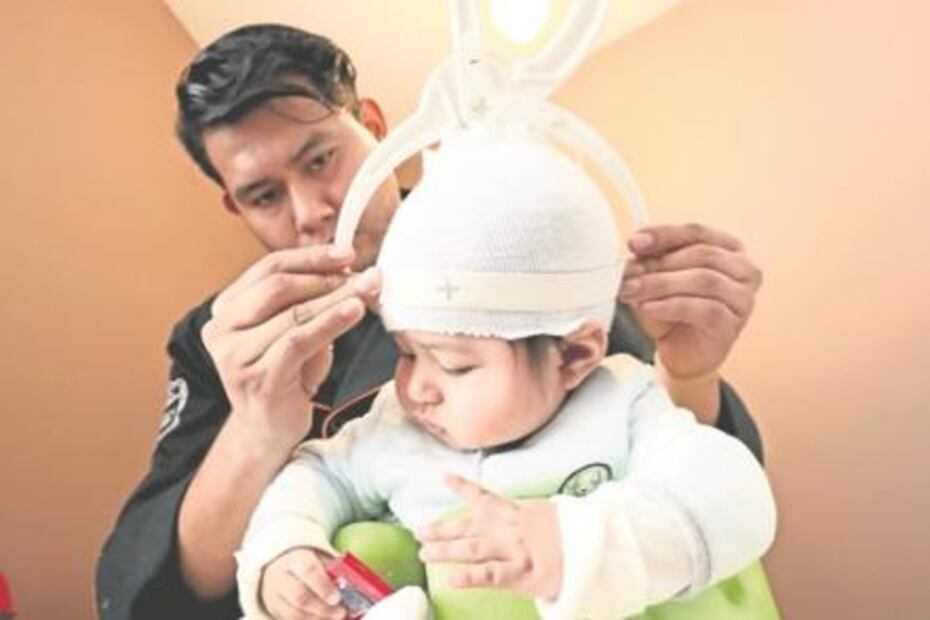 Ingeniero biónico desarrolla casquitos contra deformaciones