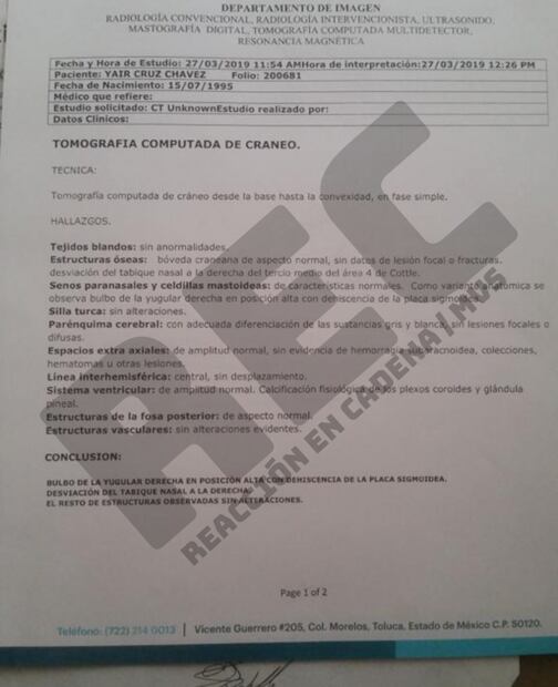 Despiden a árbitro tras sufrir ataque de epilepsia 