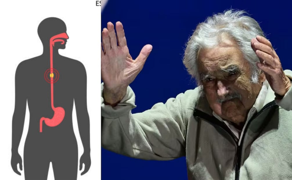 La próxima cirugía del expresidente José Mujica será un stent esofágica. (25/12/24) Fotos: iStock y Archivo