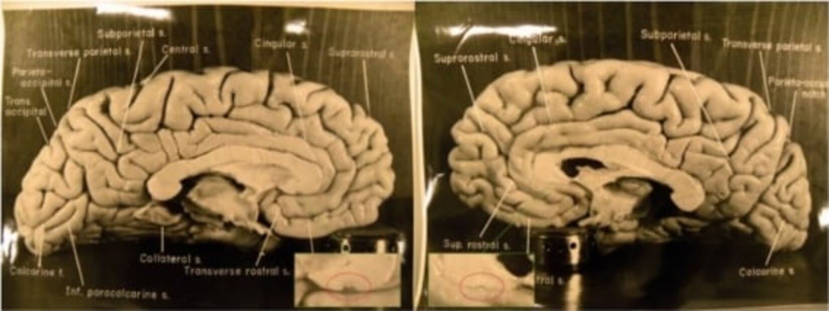 ¿En dónde está y qué pasó con el cerebro de Albert Einstein?