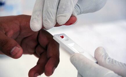 Hallan proteína en humanos inhibidora del VIH