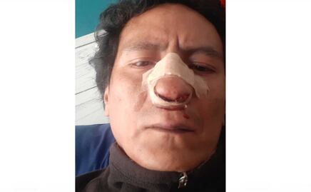 Periodista denuncia golpiza por dueños de tortillería en la colonia Roma