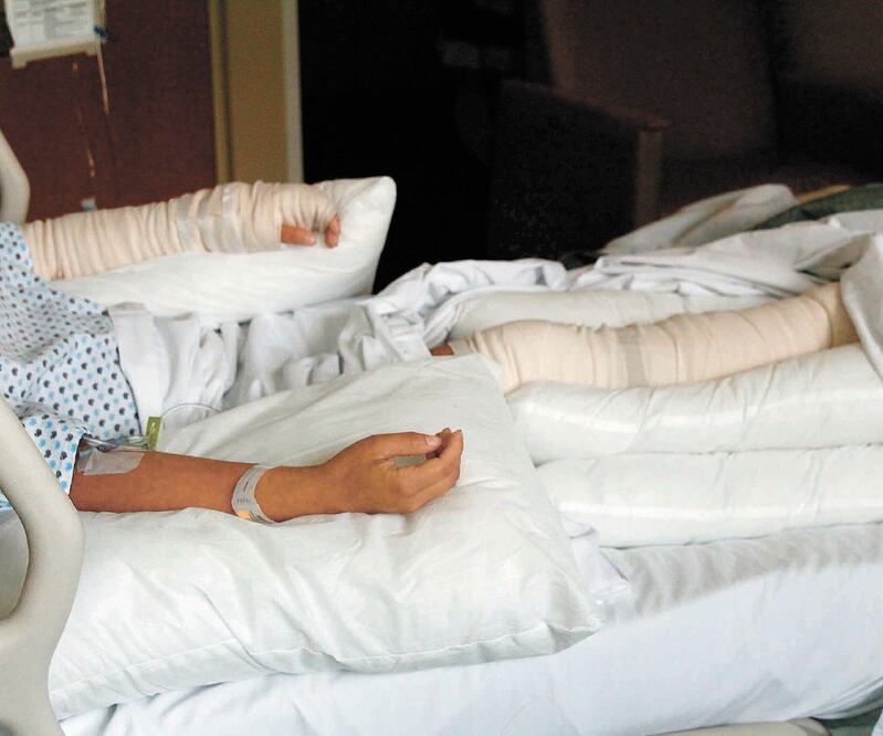 La fotógrafa resultó con heridas de segundo grado en el brazo izquierdo, así como en su pierna y tobillo derechos, por bomba lanzada en la marcha. KARINA CONTRERAS. EL UNIVERSAL