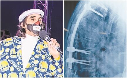 Cepillín pasó 9 horas en cirugía 