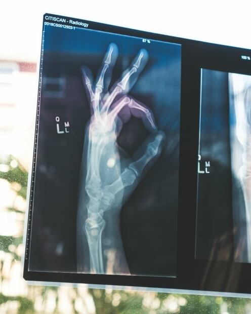 Cuidados que deben procurar los automovilistas con osteoporosis