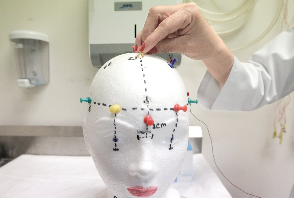 Con el tratamiento a través de impulsos electromagnéticos se trata de generar conexiones entre las redes que conforman los 86 mil millones de neuronas que cada persona tiene empacadas en el cerebro, dicen especialistas. (ALEJANDRO ACOSTA. EL UNIVERSAL)