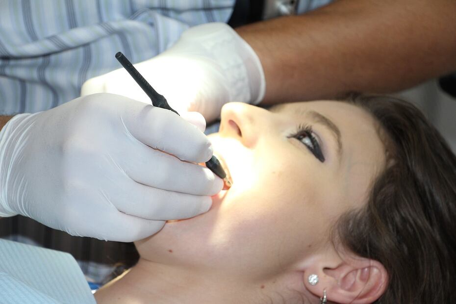 Limpieza dental. Fuente: Pixabay