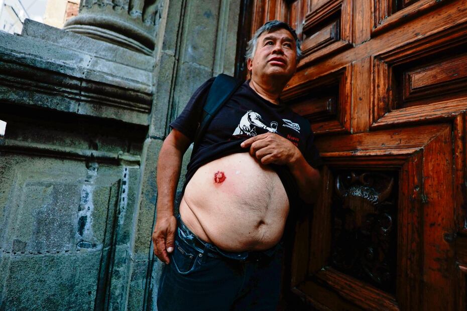 Un transeúnte resultó herido en el abdomen durante la refriega.Foto: Diego Simón / EL UNIVERSAL