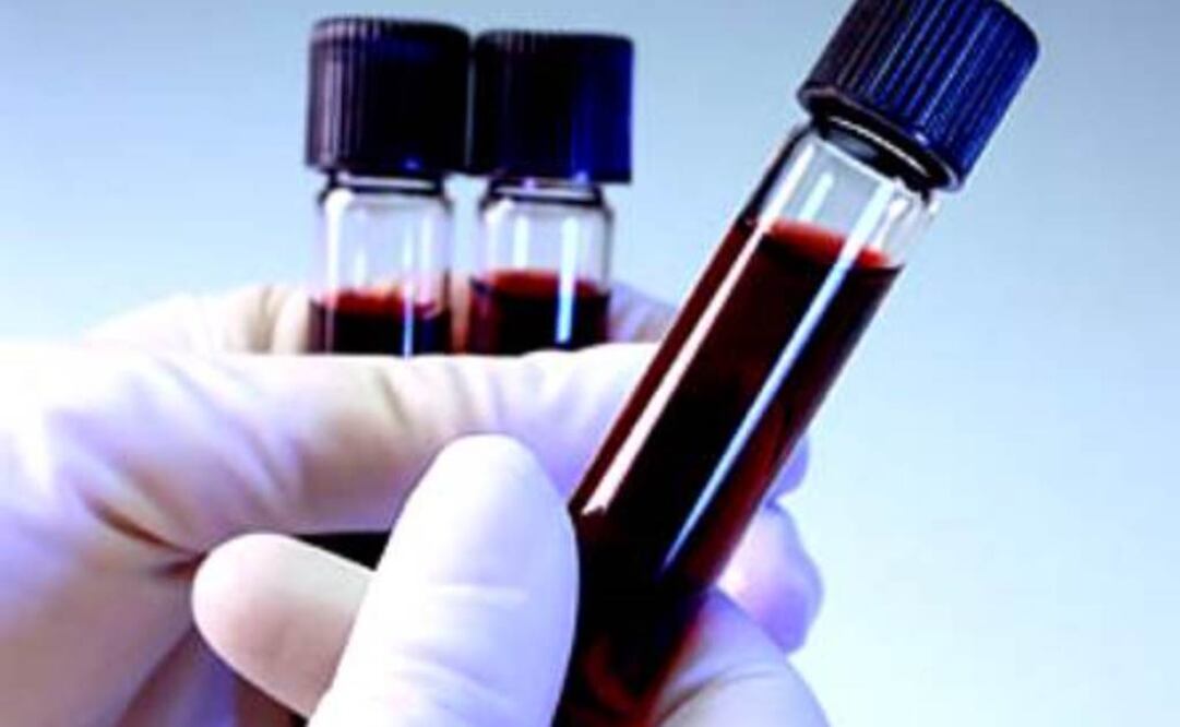 Vasos sanguíneos artificiales disponibles actualmente están hechos de materiales como los fluoroplásticos. Foto: Archivo