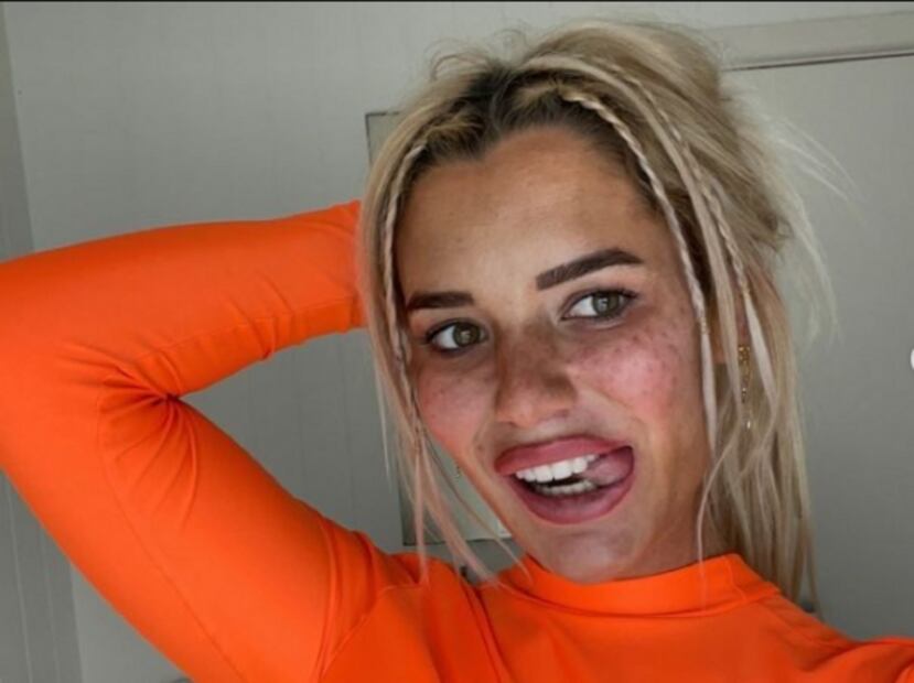 Modelo arruina su cara con tutorial de TikTok para tener pecas