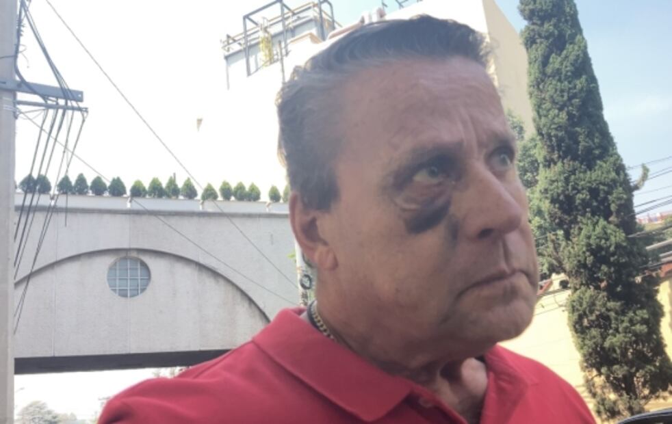 Tras golpiza, Alfredo Adame arremete contra la grafóloga MaryFer Centeno: "Es una vieja ridícula" 