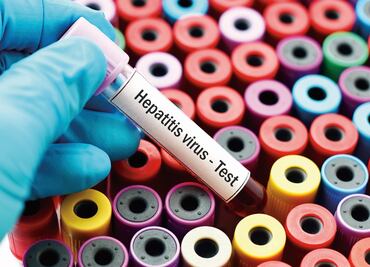 Siete cosas que hay que saber sobre la hepatitis