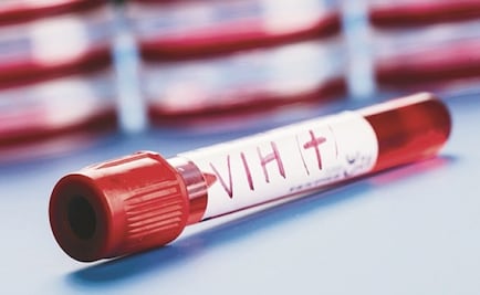 Estados Unidos aprueba nuevo tratamiento preventivo contra el VIH; "es un día histórico", destaca laboratorio