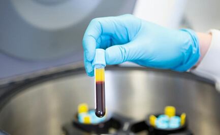 Reportan 150 casos de Metapneumovirus en Sinaloa; no representa un riesgo, dice Secretario de Salud