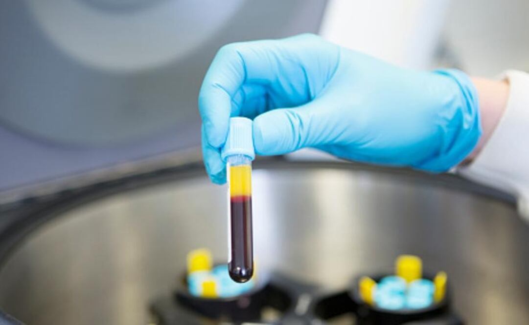 Reportan 150 casos de metapneumovirus en Sinaloa; no representa un riesgo: Secretario de Salud. Foto: Archivo/ EL UNIVERSAL