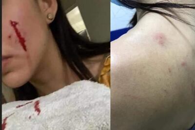 “Rodolfo Corazón” mordió primero, dice novia de joven que mató a perrito con hacha en Los Mochis