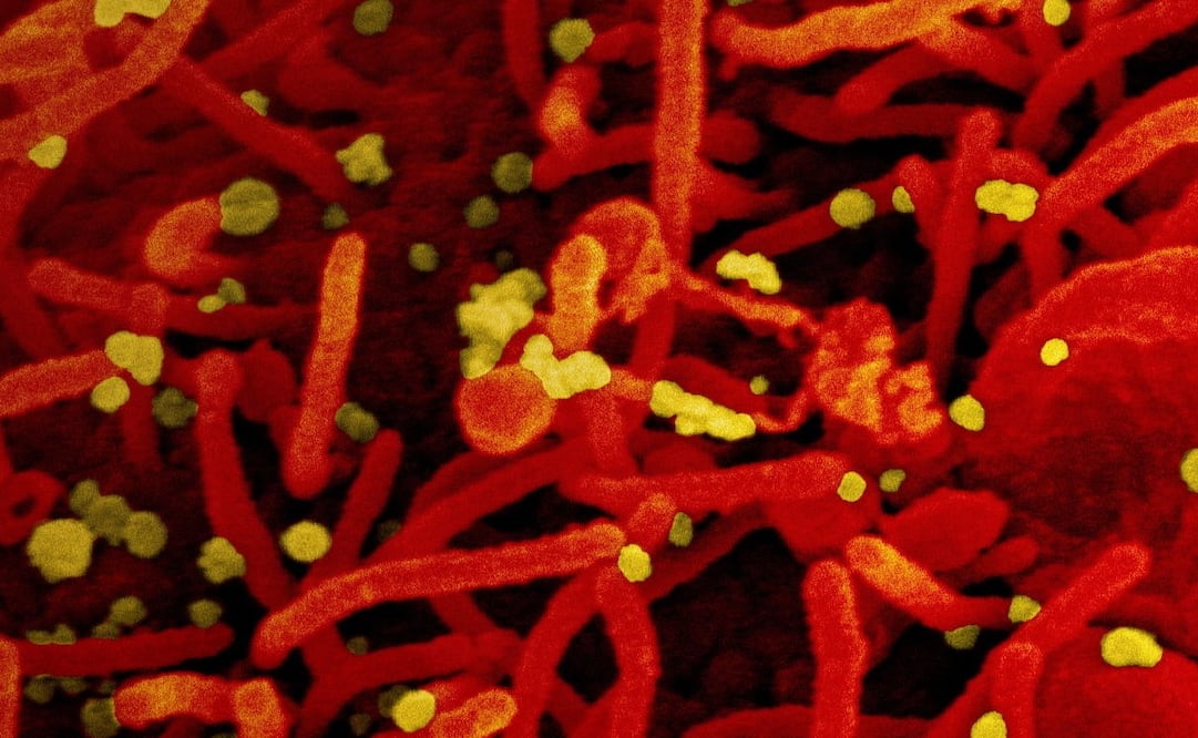 Foto: EFE/EPA/NIAID/NATIONAL INSTITUTES OF HEALTH