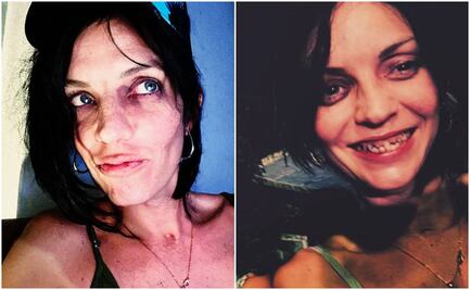 Hijo de Camilo Sesto preocupa: exhibe sus piernas en lamentables condiciones