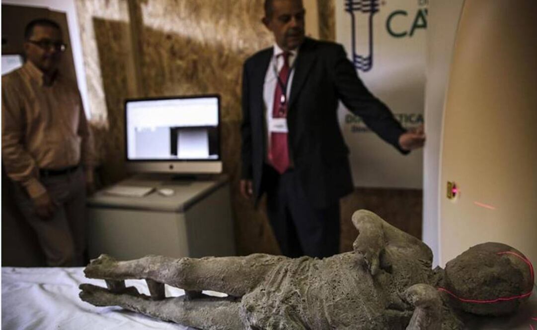 Las tomografías se realizan a los moldes de yeso que aprisionan los restos de los habitantes de Pompeya. Foto:EFE