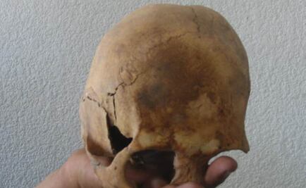 Hallan esqueleto del siglo II con cráneo "alienígena"