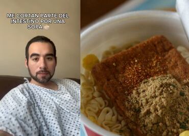 Joven acusa a sopa instantánea de terminar en hospital por problemas intestinales