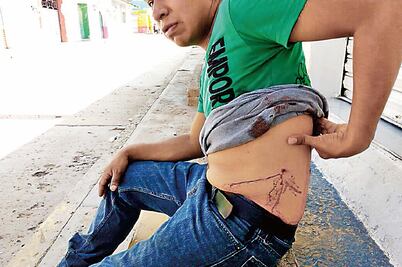 “Había heridos de bala en piernas y rodillas”