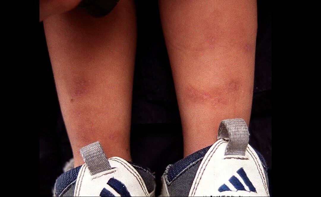 (Foto: Archivo EL UNIVERSAL)