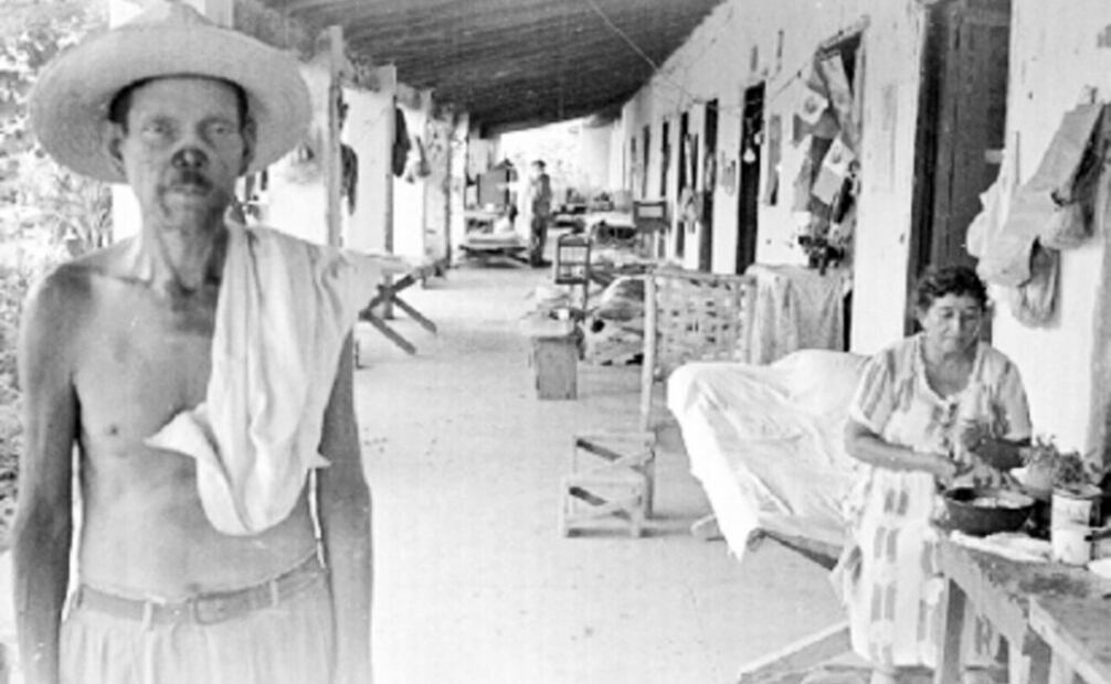 Paciente de un leprosario en Sonora, en 1955. En octubre de 1933, el dermatólogo Daniel M. Vélez declaró frente a la Academia Nacional de Medicina que, “si bien [la estadística de 1927] no llega a resultados exactos, sí señalaron el camino que México deberá seguir para la localización de lepra y dar la primera voz de alarma y de prevención contra el mal”. Foto: Mediateca INAH.