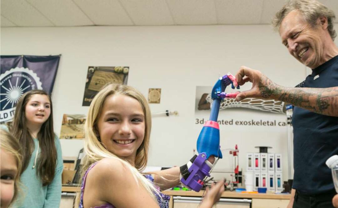 Stephen Davies fue quien diseñó el brazo y subió el video a YouTube