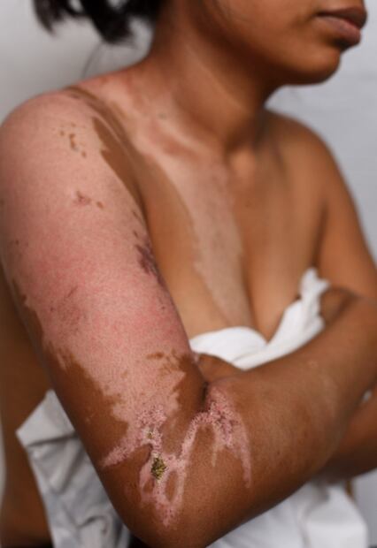 Fotógrafo de EL UNIVERSAL es reconocido con Premio Alemán de Periodismo Walter Reuter