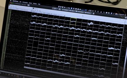 Pacientes con parálisis total podrán comunicarse con ayuda de inteligencia artificial