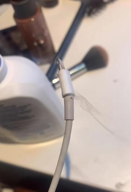 Joven queda parcialmente ciega luego que el cable de su teléfono explotara