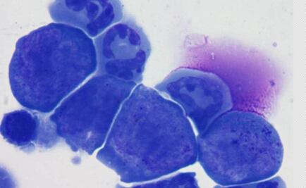 Identifican cómo el organismo elimina células defectuosas