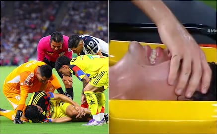 Liga MX: La espeluznante lesión de Dagoberto Espinoza, joven futbolista del Club América