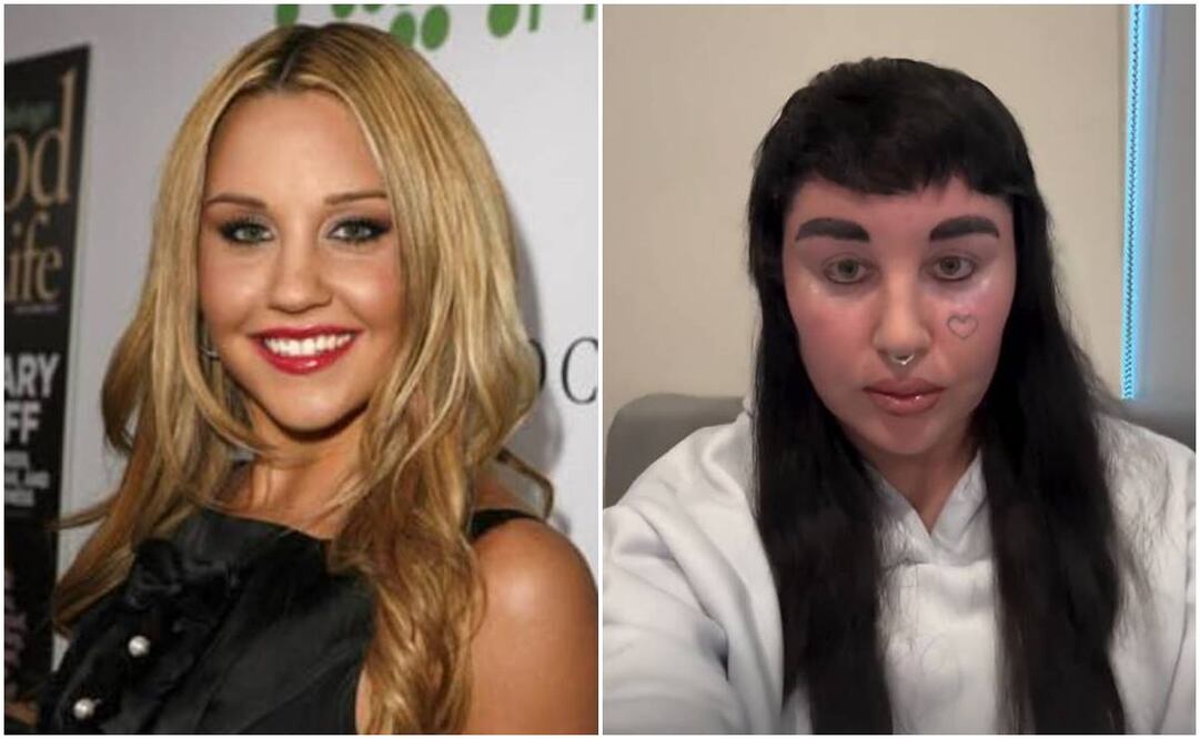 Amanda Bynes antes y actualmente. Foto: WireImage.com/Instagram amandaamandaamanda1986