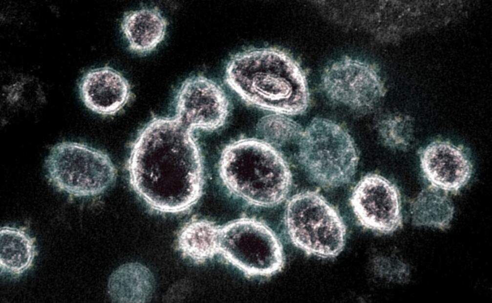 Descubren que proteína del coronavirus presenta 13 mutaciones a la vez en Tanzania