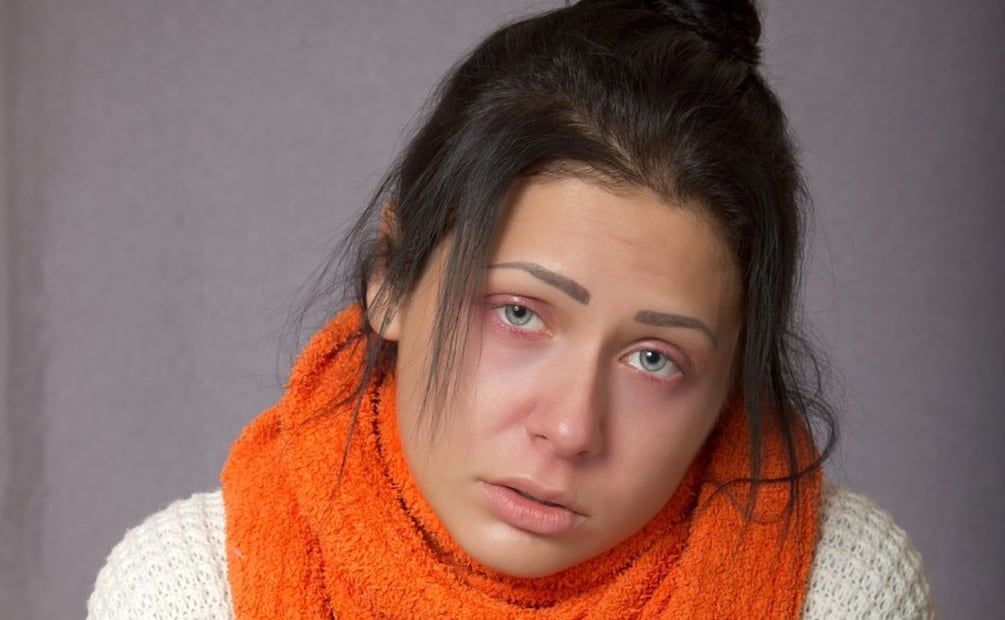 Alimentación contra las ojeras. Fuente: Pixabay