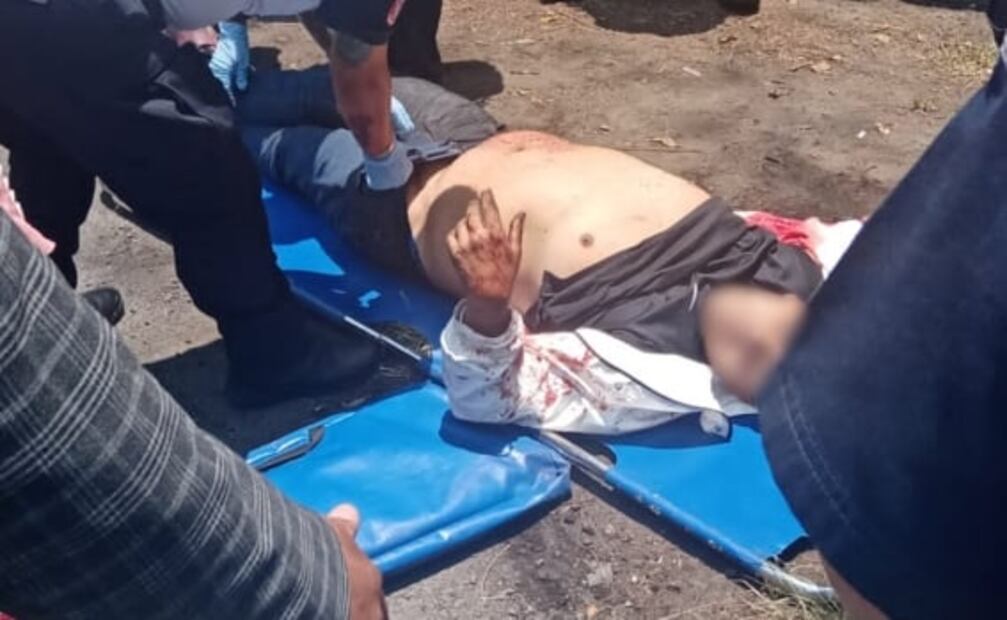 Balean a automovilista en carriles centrales de Periférico Norte