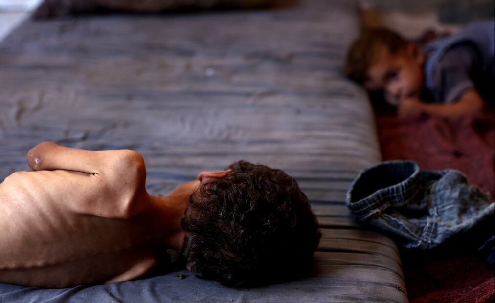 Yazan, un niño palestino de dos años desnutrido yace en un colchón junto a su hermano en el campo de refugiados de Al-Shati, en la ciudad de Gaza, el 23 de julio de 2025. Foto: AFP