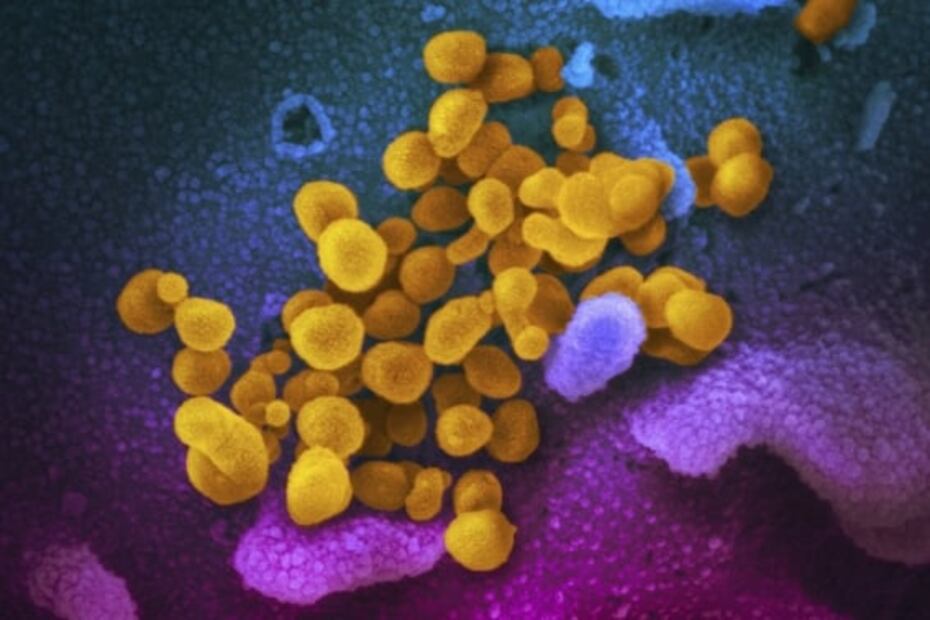 Descubren posibles fármacos contra Covid-19 que estarían aprobados por la FDA