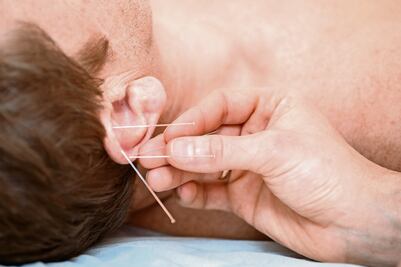 Auriculoterapia: para tratar enfermedades crónicas