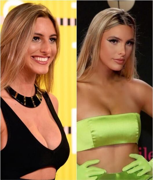 Lele Pons: esta es la cirugía que le cambió la vida a la sobrina de Chayanne